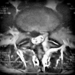 ENDOSCOPIC SURGERY